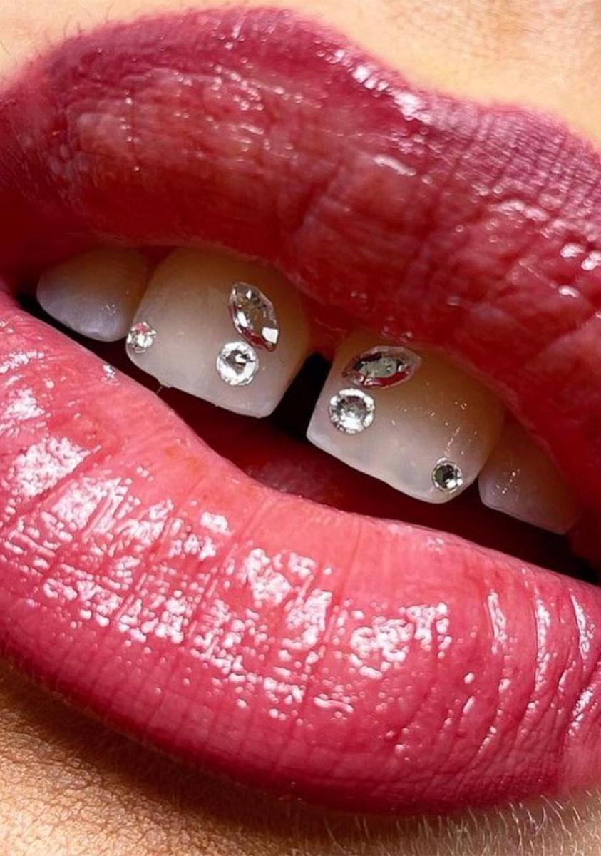 rollover